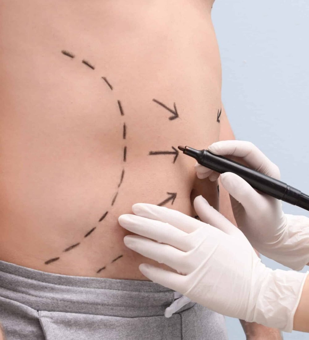 Male Plastic Surgery